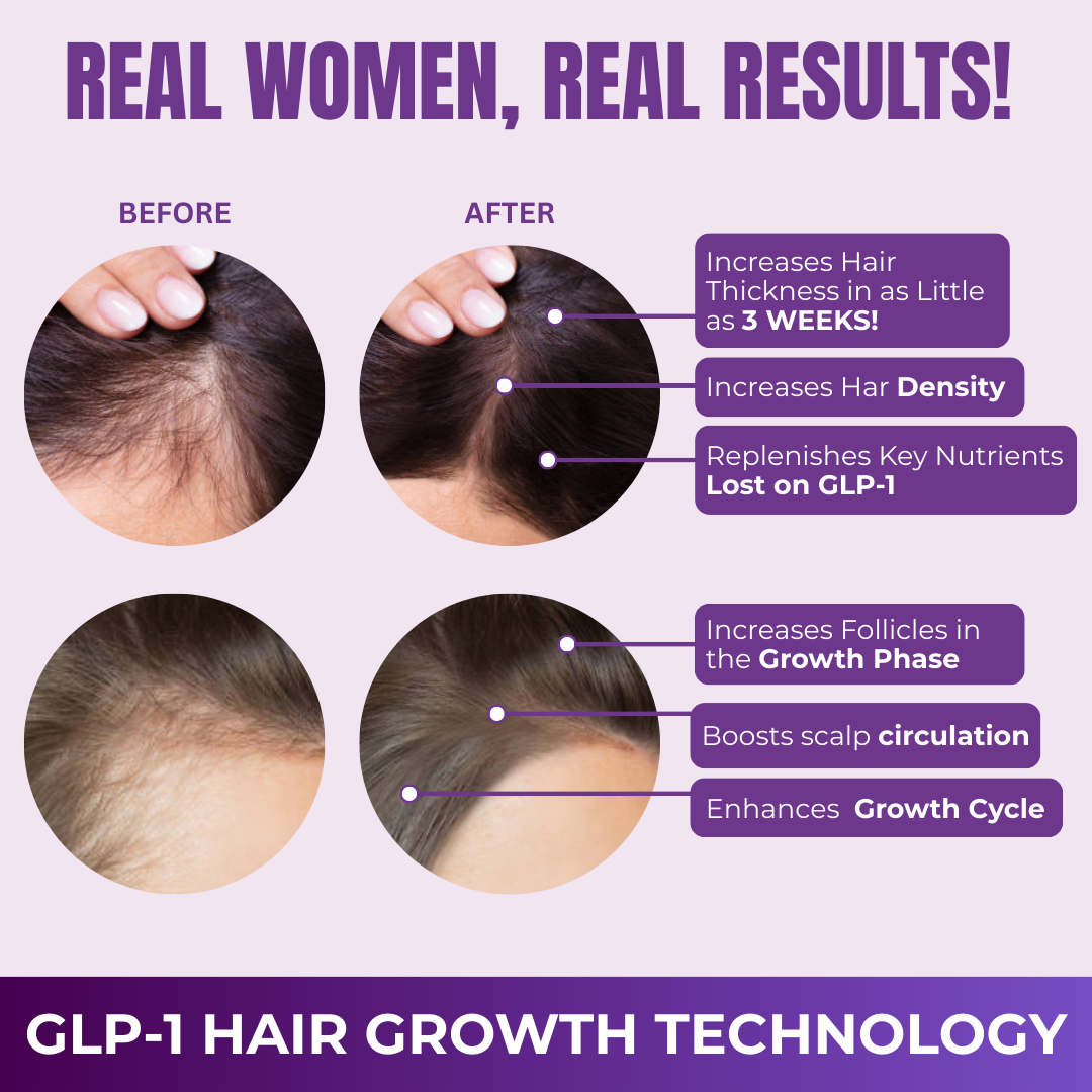 FORCE FACTOR Hair Growth Accelerator Capsules & Soft Chews