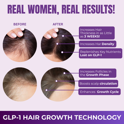 FORCE FACTOR Hair Growth Accelerator Capsules & Soft Chews