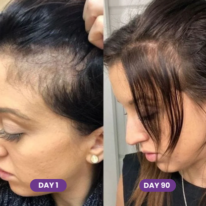 FORCE FACTOR Hair Growth Accelerator Capsules & Soft Chews