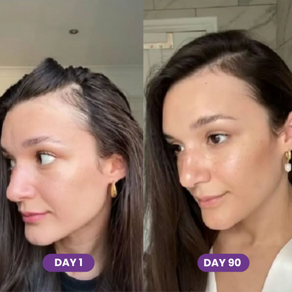 FORCE FACTOR Hair Growth Accelerator Capsules & Soft Chews