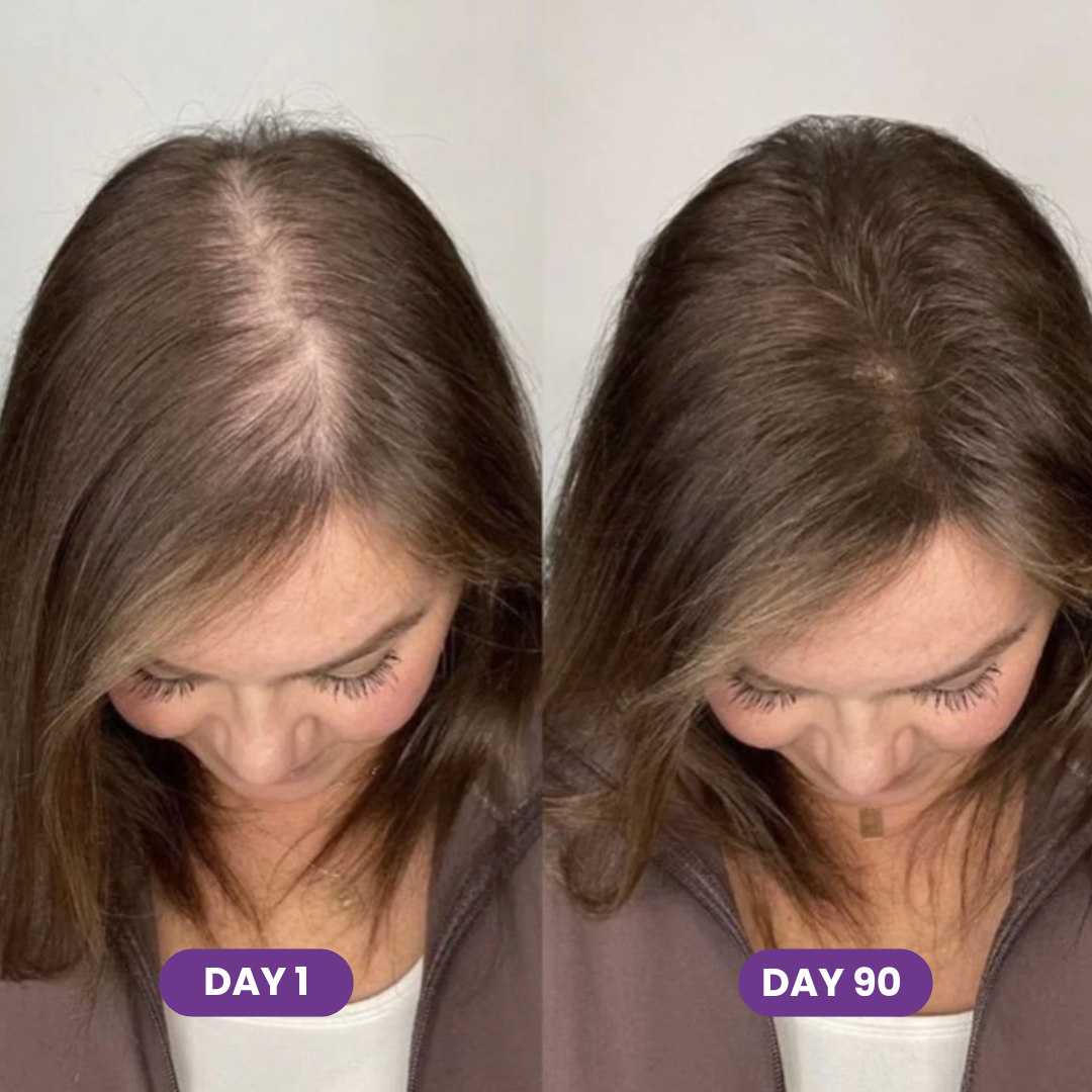 FORCE FACTOR Hair Growth Accelerator Capsules & Soft Chews